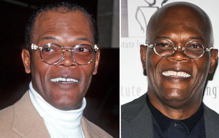How They Looked: Famous Bald Celebs Before Going Bald