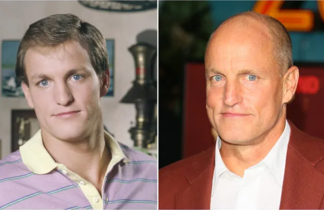 How They Looked: Famous Bald Celebs Before Going Bald