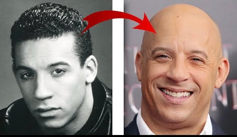 How They Looked: Famous Bald Celebs Before Going Bald